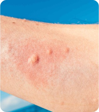 sensitive-skin-skin-care-formulation