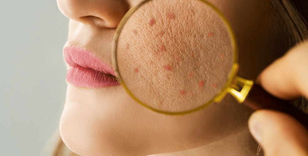 skincare-for-teens-top-formula